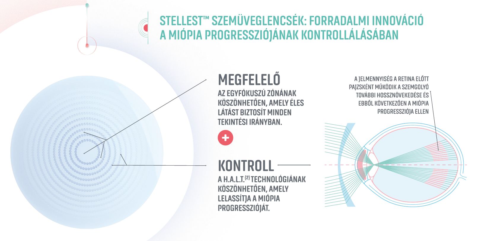 Essilor Stellest új fejlesztésű szemüveglencse a rövidlátás lassítására 3